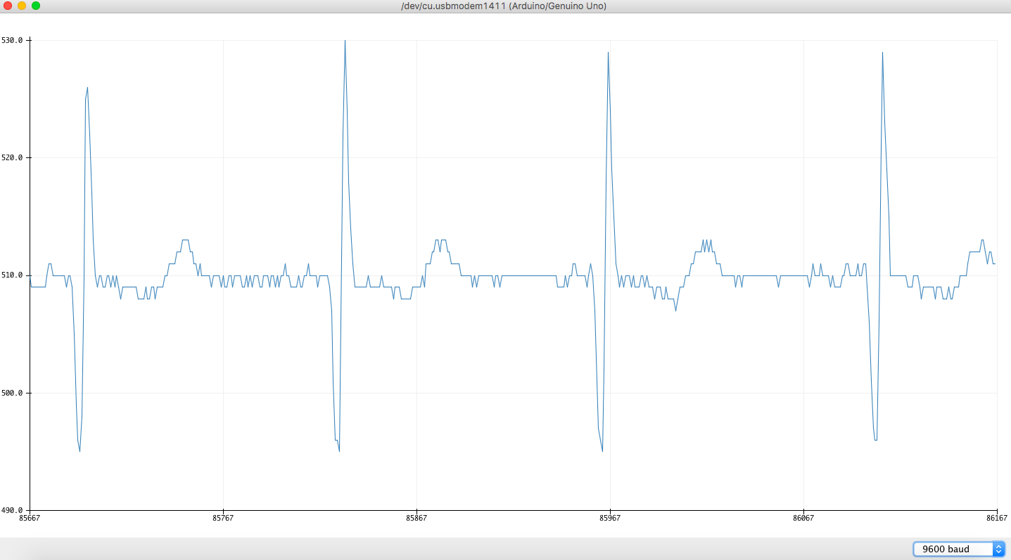 ecg2.png