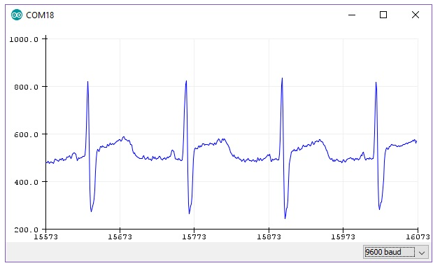 ecg3.PNG